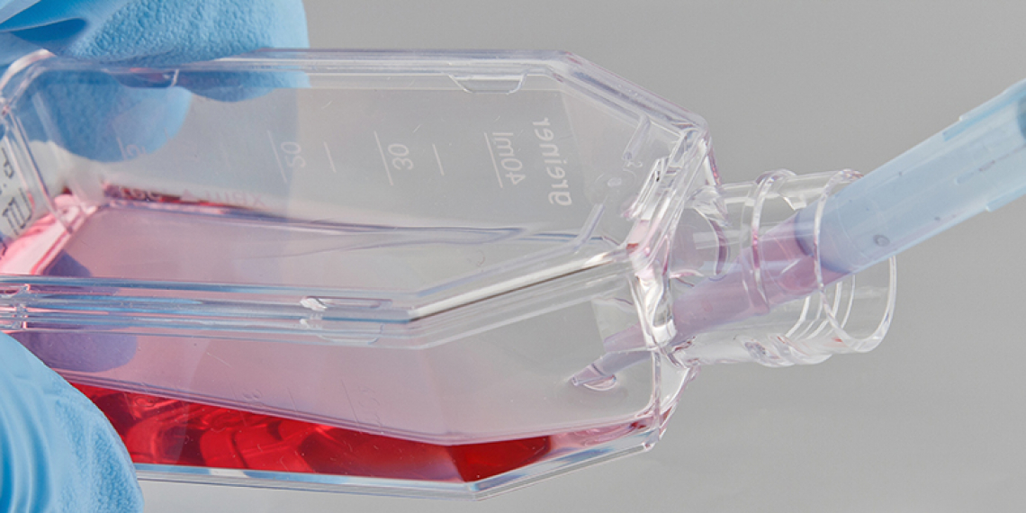 Photo of cell culture bottle