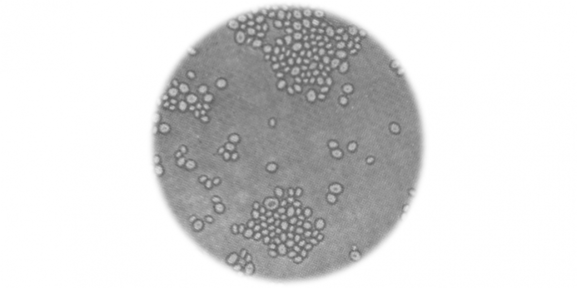 Microscope image of yeast cells