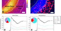 Images of metals in the brain