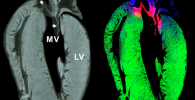 Mass spectrometry image of rat heart