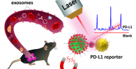 Schematic representation of circulating exosomal PD-L1 detection using SERS-sandwic